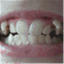 calebinbraces.wordpress.com