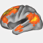 mysocialbrain.org