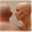 alopeciaantics.com