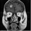 neurosurgerybasics.com