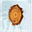 hyperoxalurie.de