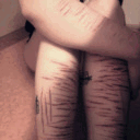 my-little-self-harm.tumblr.com